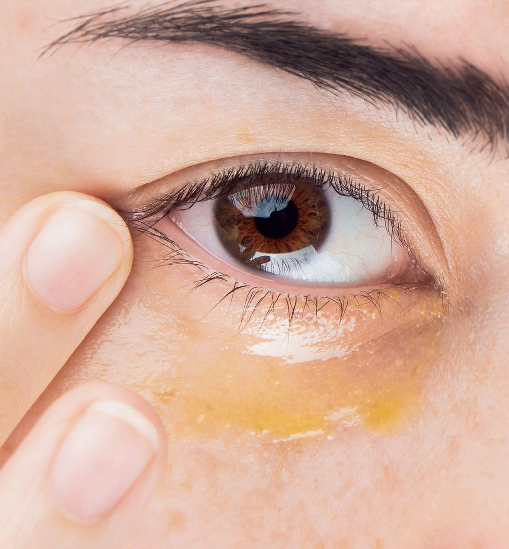 How to Get Rid of Under Eye Bags: Causes and Effective Solutions